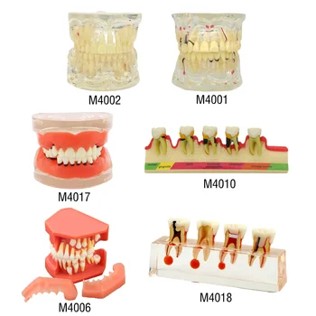 Стоматологичен модел патологични на зъбите, Пародонта/Имплантиране/Эндодонтическое Проучване на зъбния кариес и Демонстрационен Модел на зъбите Typodont